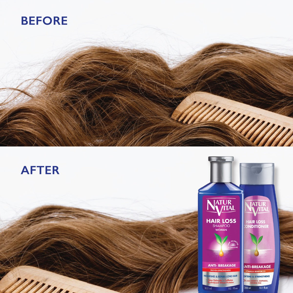 NaturVital Anti-Breakage Hair Loss Shampoo for Women, 300ml (Exp 07/28)