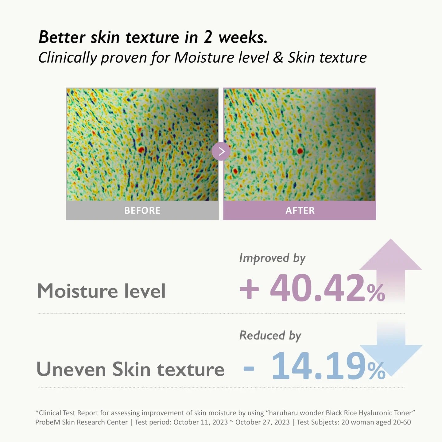 haruharu wonder Black Rice Hyaluronic Toner, 300ml (Exp 07/27)