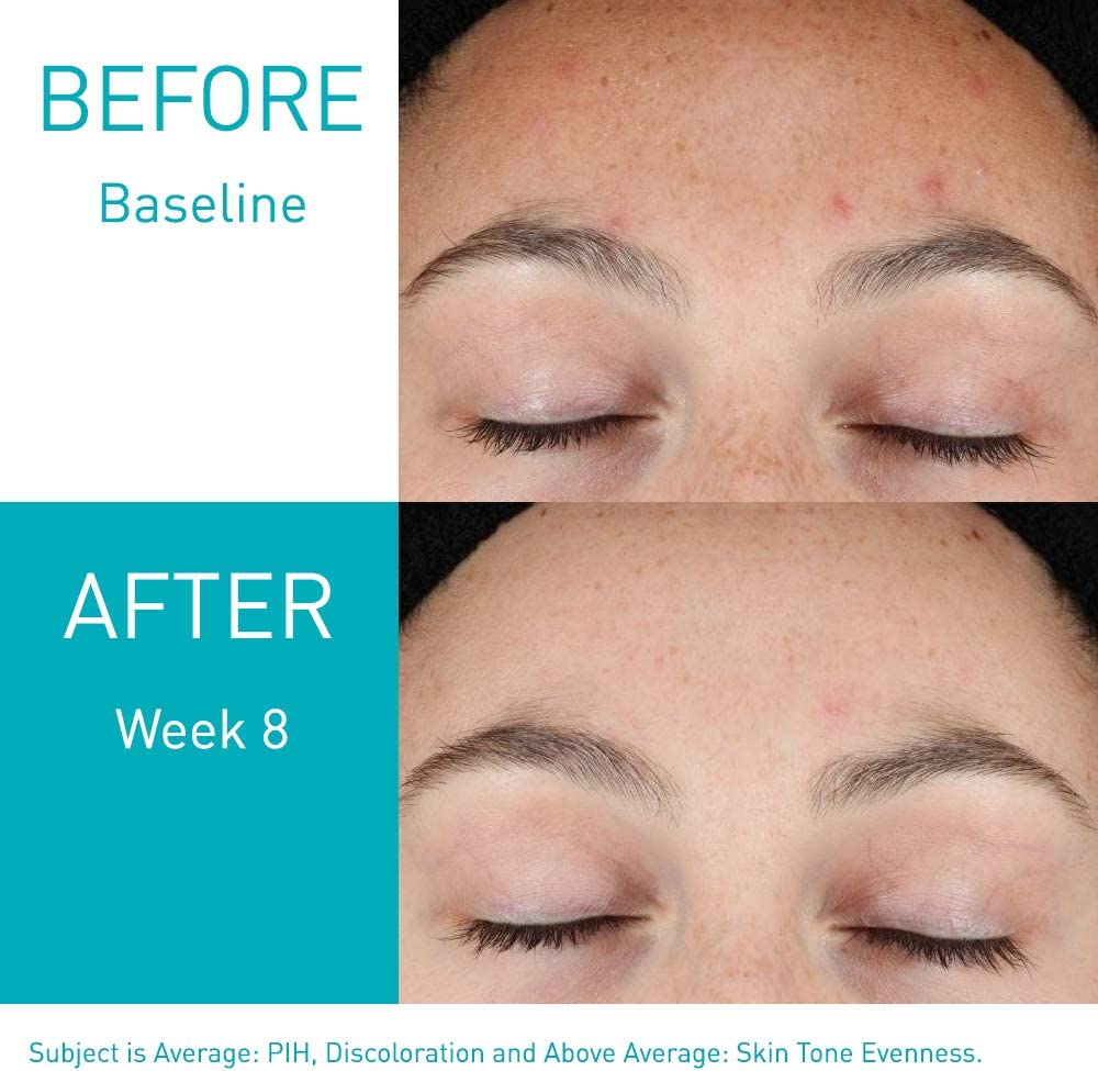 CeraVe Resurfacing Retinol Serum, 30ml (exp 01/28)