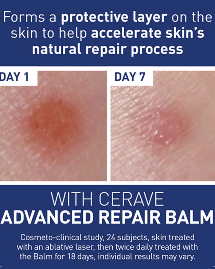 CeraVe Advanced Repair Balm, 88ml (Exp 09/26)