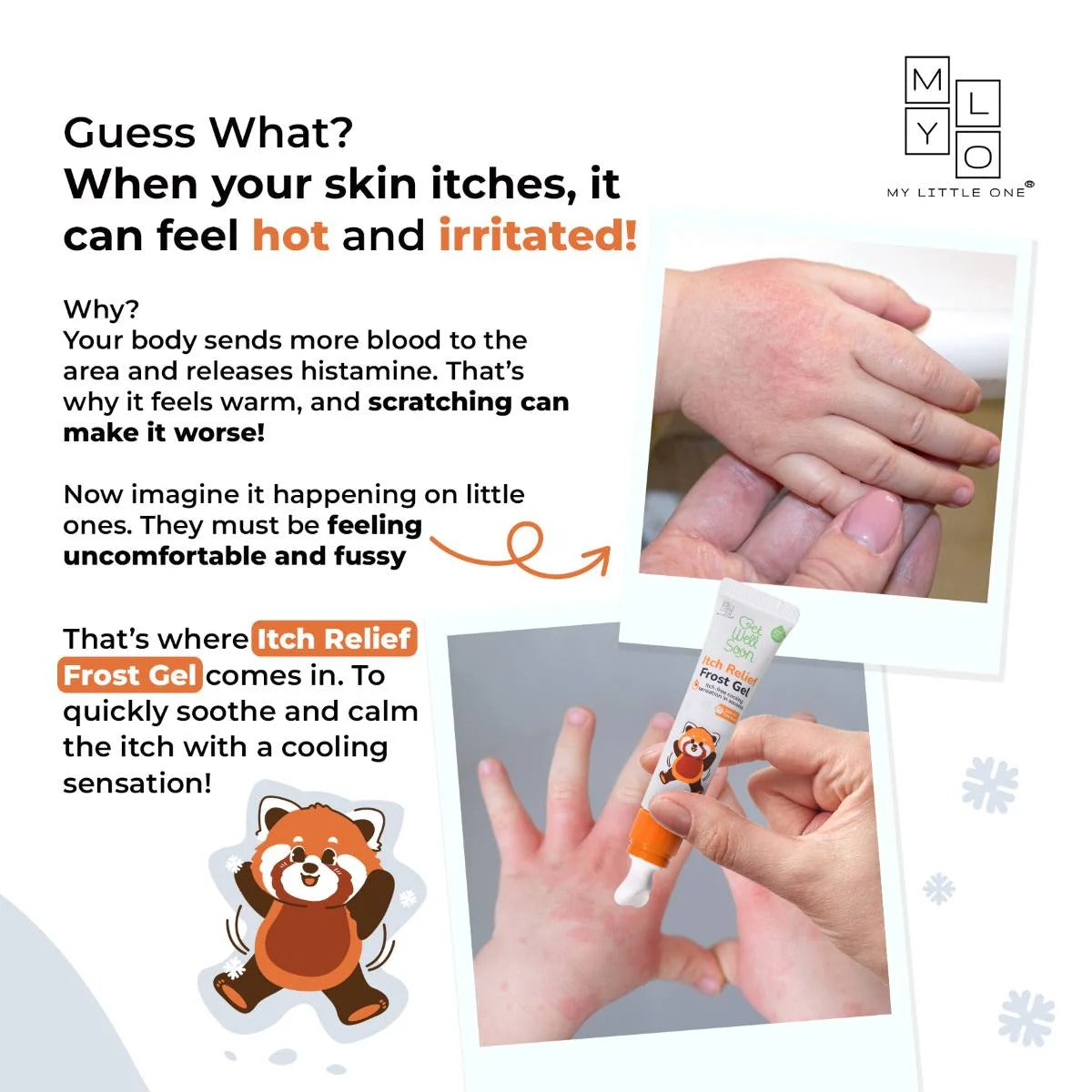 MyLO GWS Itch Relief Frost Gel, 15g (Exp 07/27)