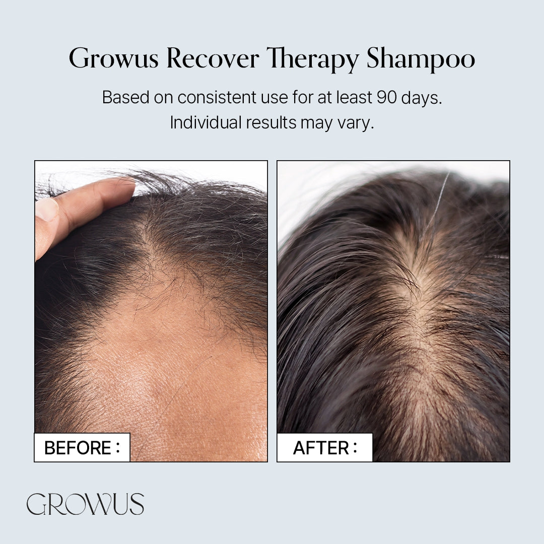 Growus Recover Therapy Shampoo for Woman, 500ml (Exp 05/28)