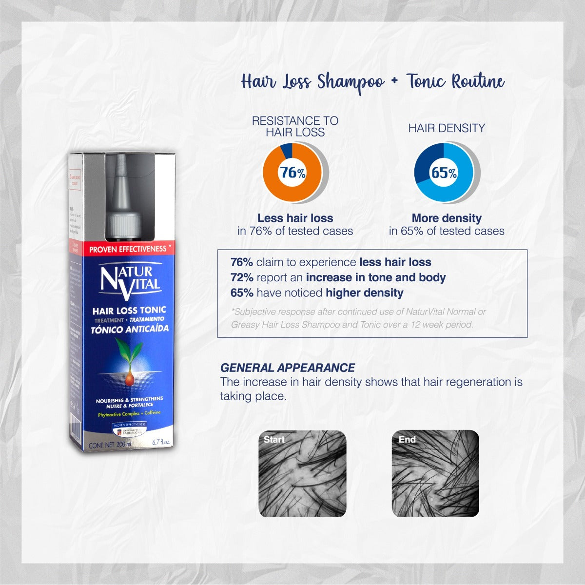 NaturVital Hair Loss Tonic, 200ml (Exp 02/29)