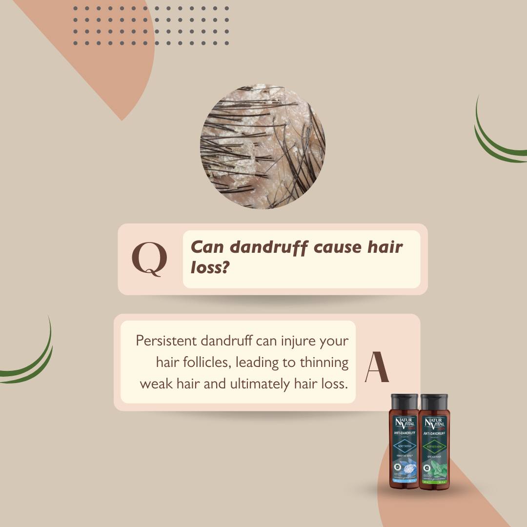 NaturVital Invigorating Anti-Dandruff Hair Loss Shampoo for Men, 300ml