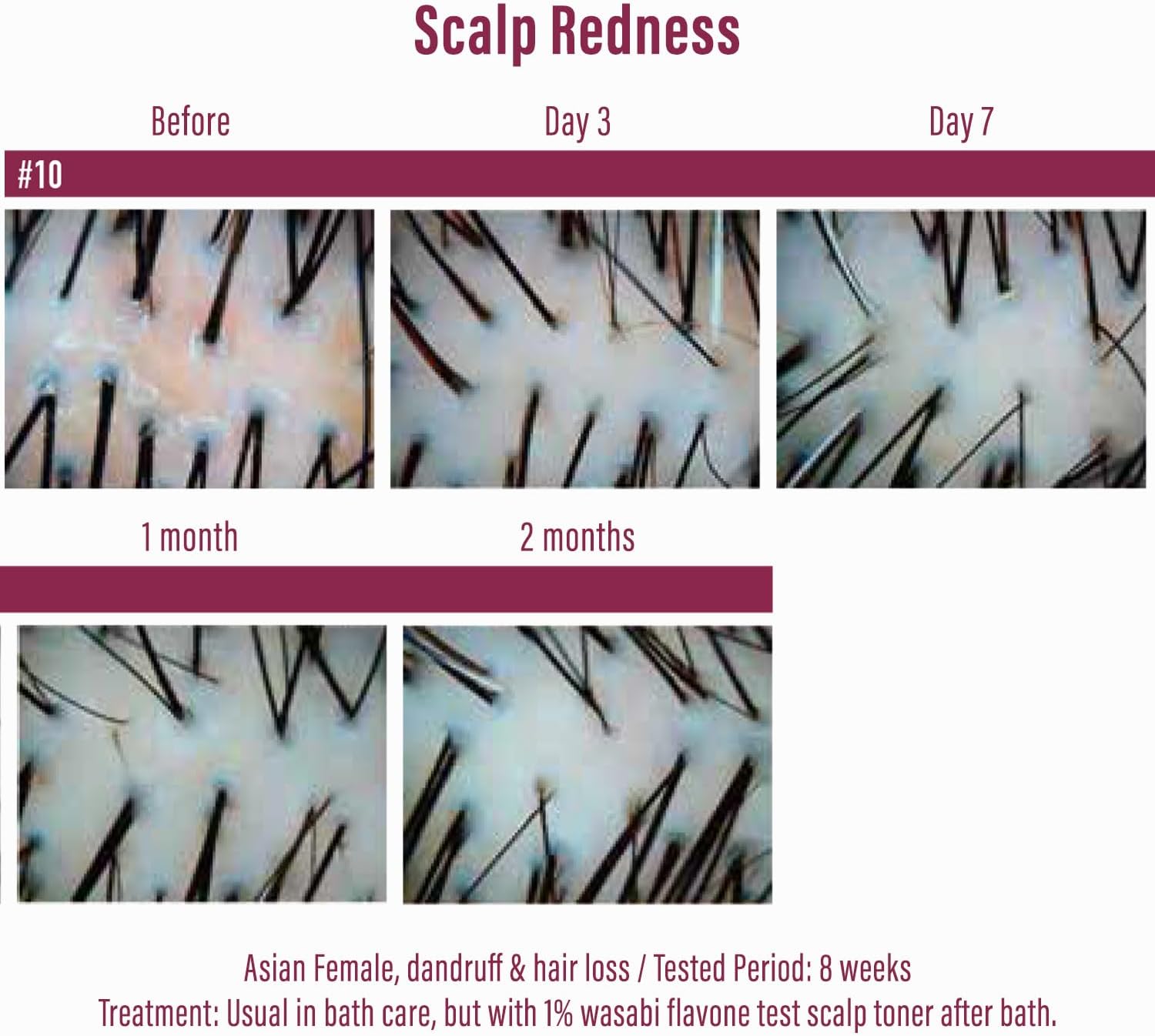 Moist Diane Extra Hair Fall Control Shampoo (450ml)