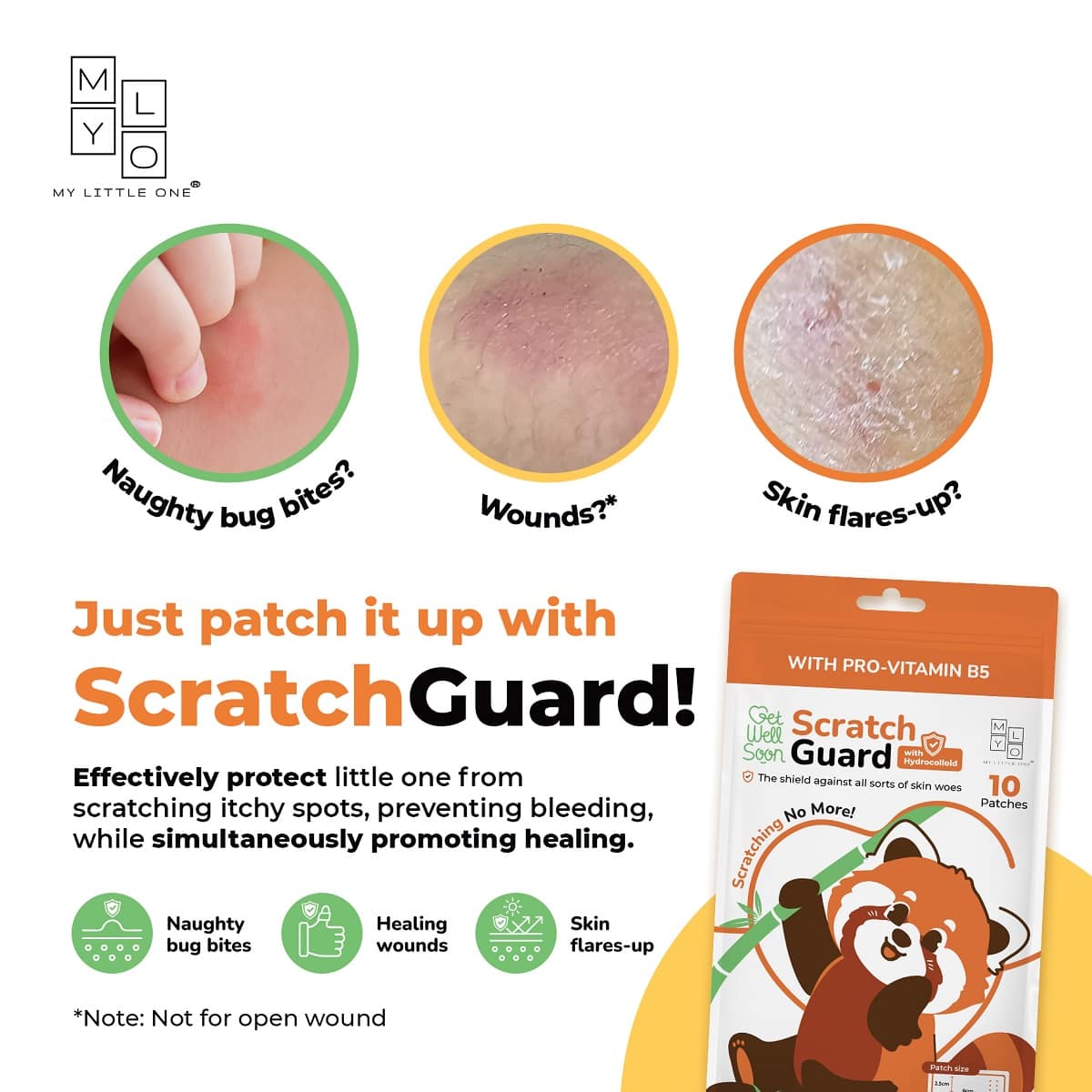 MyLO ScratchGuard Relief Patch, 10pcs (Exp 06/27)