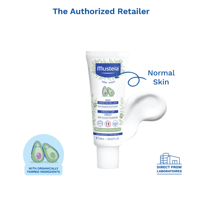 Mustela Cradle Cap Cream, 40ml (NEW) - exp 01/28