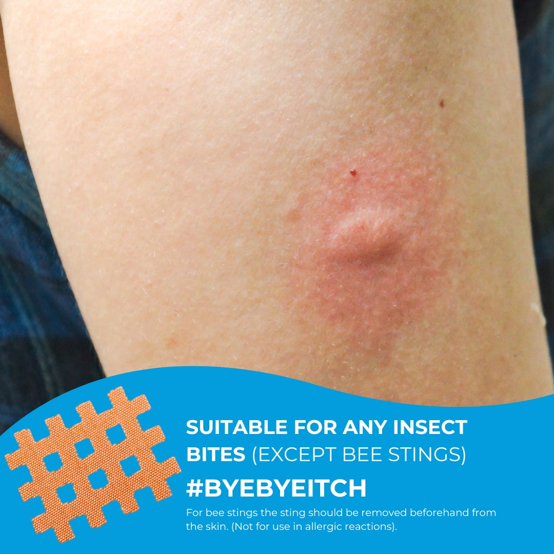 Moskinto Anti-Itch Relief Mosquito Patches, 24pcs (Exp 12/26)