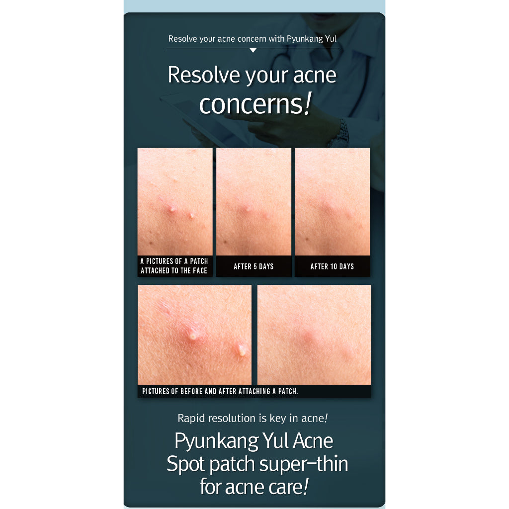 Pyunkang Yul Acne Spot Patch Super Thin, 1 Sheet 15 patches (Exp 11/26)