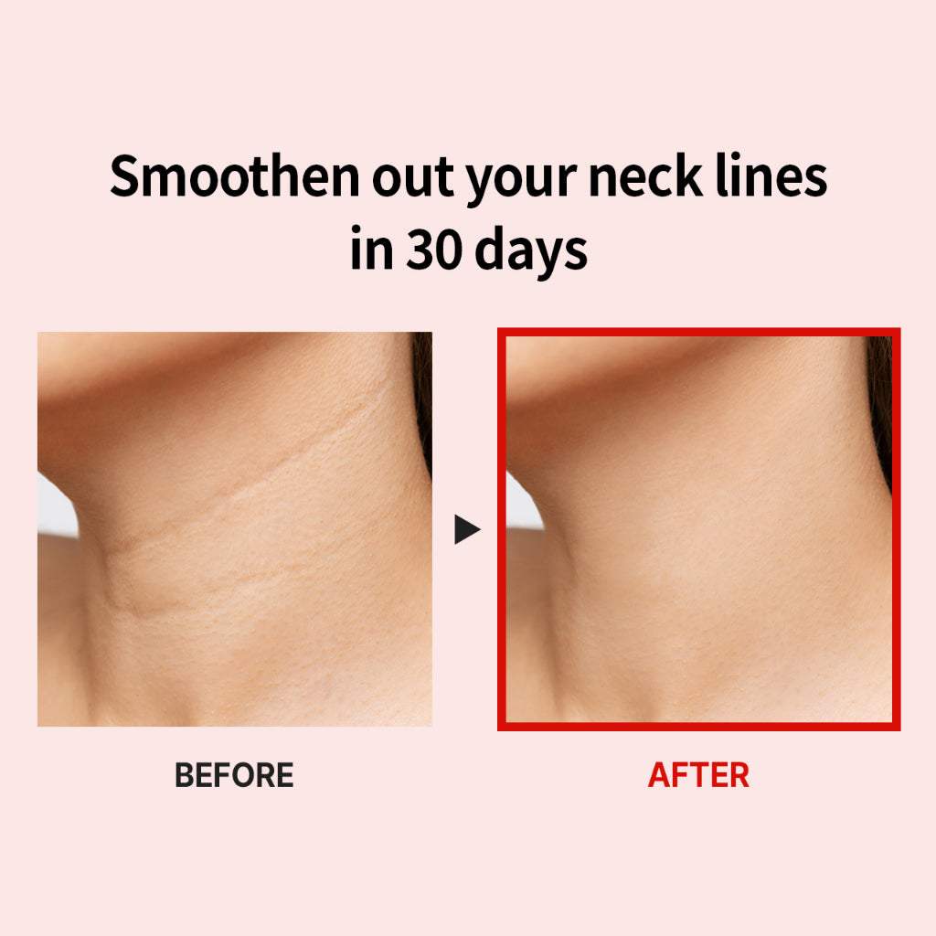 Medipeel Premium Naite Thread Neck Cream, 100ml (Exp 01/28)