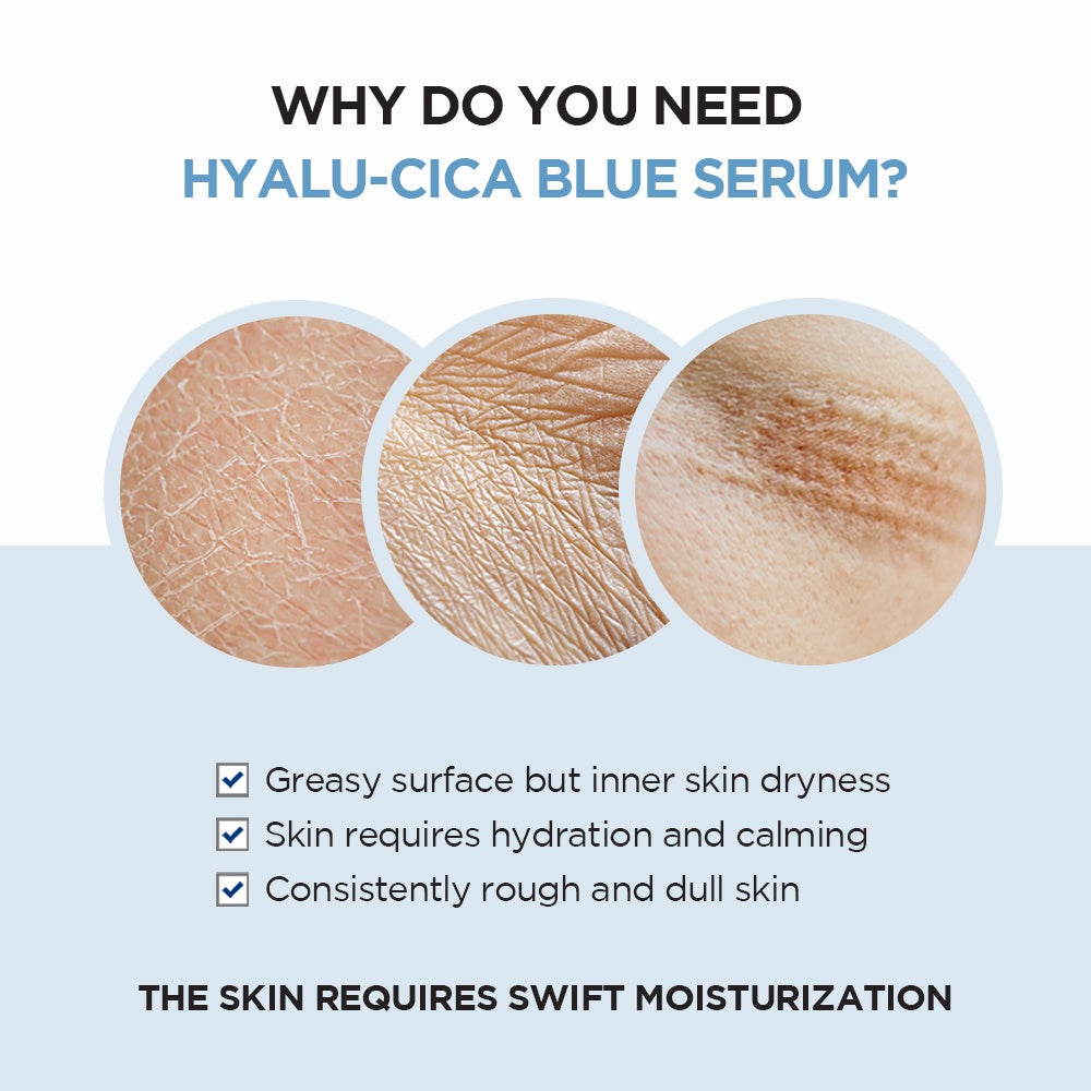 SKIN1004 Madagascar Centella Hyalu-Cica Blue Serum, 50ml (Exp 04/27)