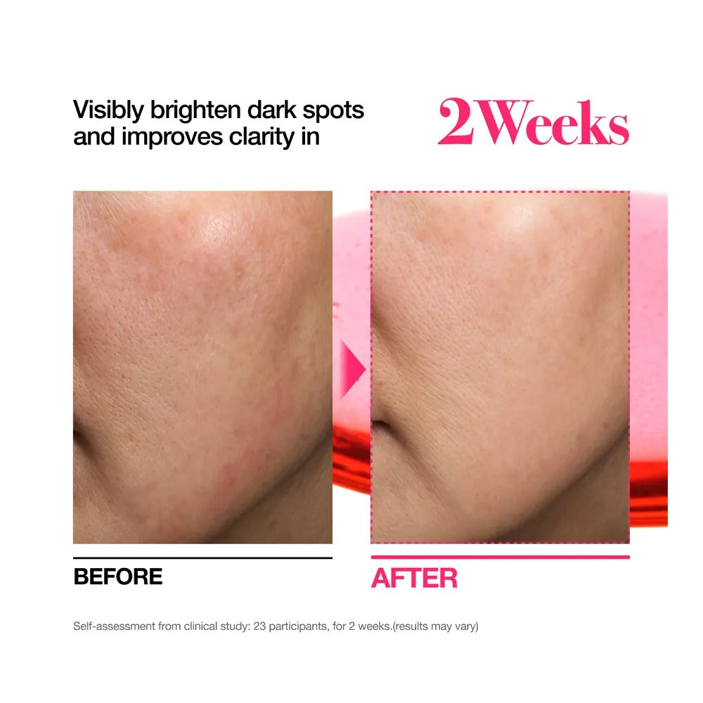 Anua Niacinamide 10% + TXA 3% Dark Spot Correcting Serum, 30ml (Exp 06/28)